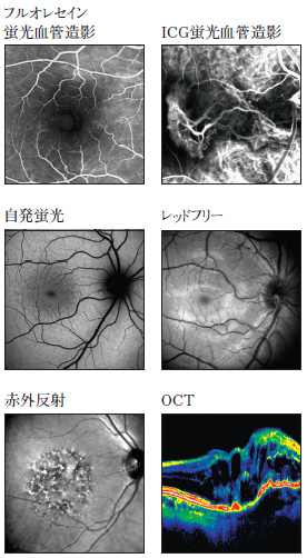 ６つのモダリティ画像