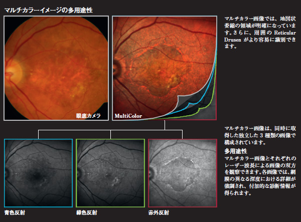 マルチカラーイメージの多用途性