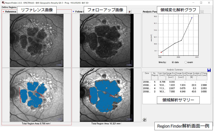 Region Finder解析画面一例