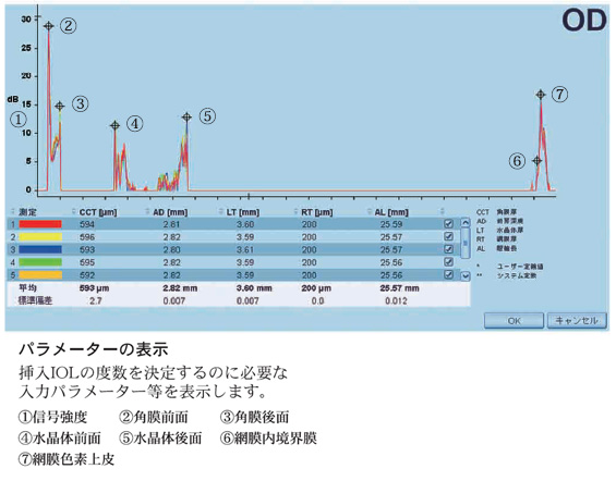 パラメーターの表示