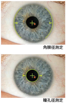 角膜径・瞳孔径測定図