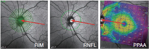GMPE を用いたRIM,RNFL,PPAA図