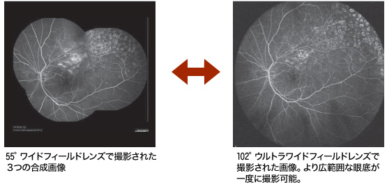 より広範囲な眼底が一度に撮影可能