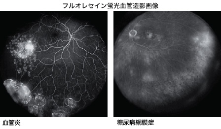 より周辺部の画像診断