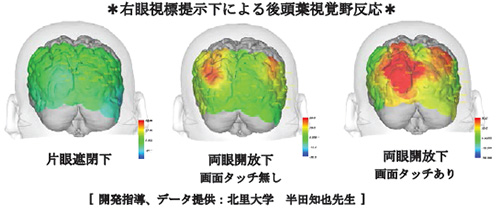 右眼視標提示下による後頭葉視覚野反応