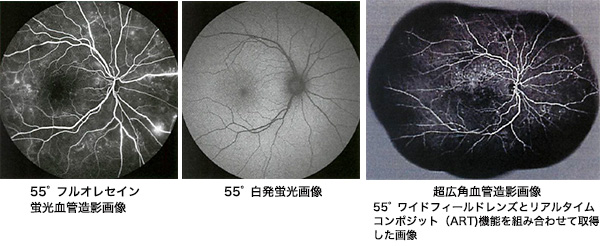 55°ワイドフィールドレンズを用いた撮影画像