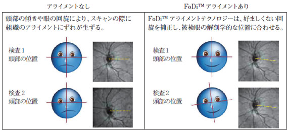 被験者の検査