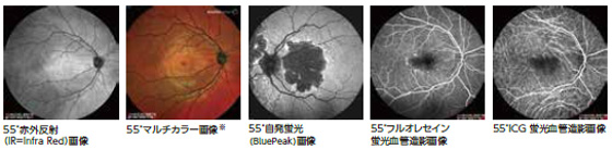 各種コンフォーカルSLO眼底画像